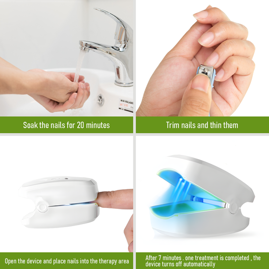 Nail Fungus Laser Device with Light Therapy Effective Onychomycosis Toes Treatment
