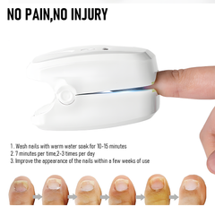 Nail Fungus Laser Device with Light Therapy Effective Onychomycosis Toes Treatment