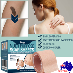 South moon Birthmark Skin Tone Concealer, Cover Body Scars Tattoo Spots Waterproof Color Masking Tape