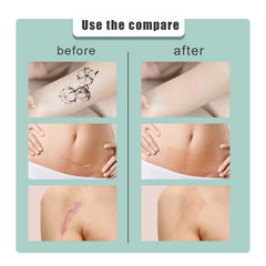 South moon Birthmark Skin Tone Concealer, Cover Body Scars Tattoo Spots Waterproof Color Masking Tape